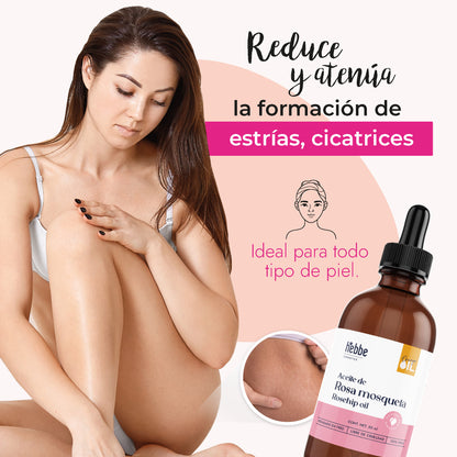 Kit 3 Aceites de Rosa Mosqueta | Facial y Corporal | Tratamiento Regenerador, Antiedad y Cicatrizante